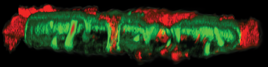 Nuclear complexity - the nucleoplasmic reticulum 